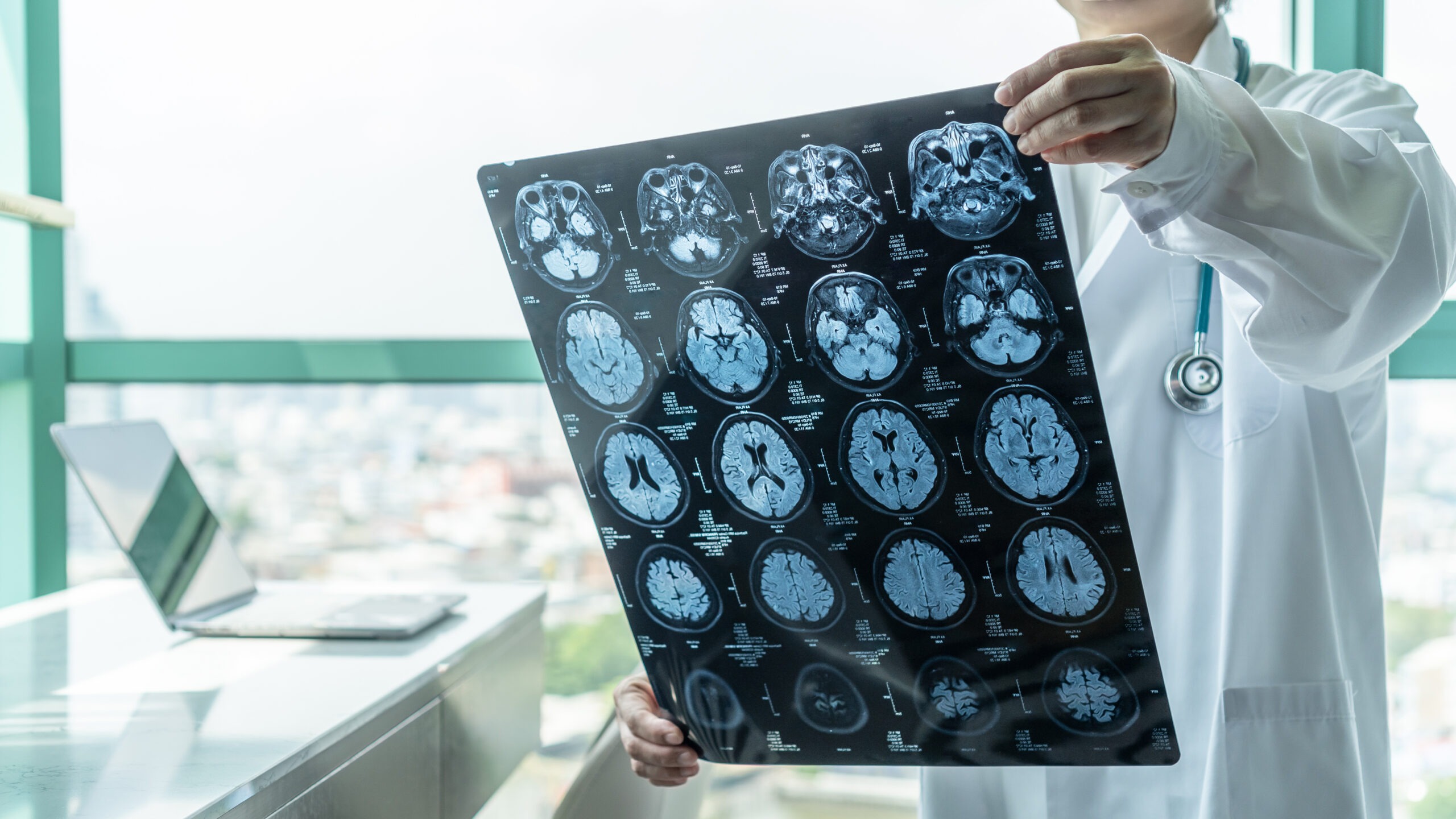 tryon-nc-brain-injury-lawyer