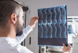 Mt. Holly Spinal Cord Injury Lawyer