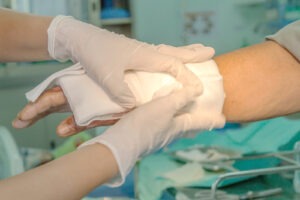 Gastonia Burn Injury Lawyer