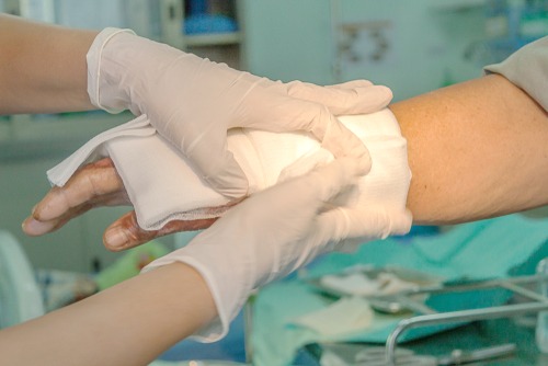 Gastonia Burn Injury Lawyer