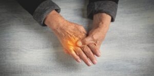 Image of a hand illustrating the question “Does Arthritis Qualify for Disability?”