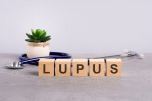 Wooden block on table spelling out lupus for an article that explains whether lupus qualifies for disability.