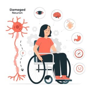 Does MS Qualify for Disability